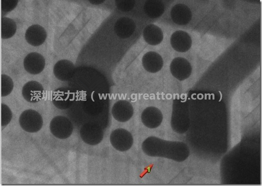 BGA因为焊垫变小，造成锡膏过多而最终形成焊接短路的结果。